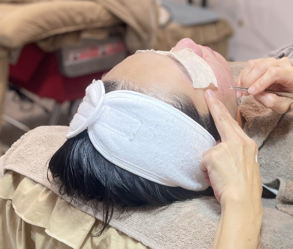 草光掏耳紋繡生活美學 照顧痘痘肌臉部保養